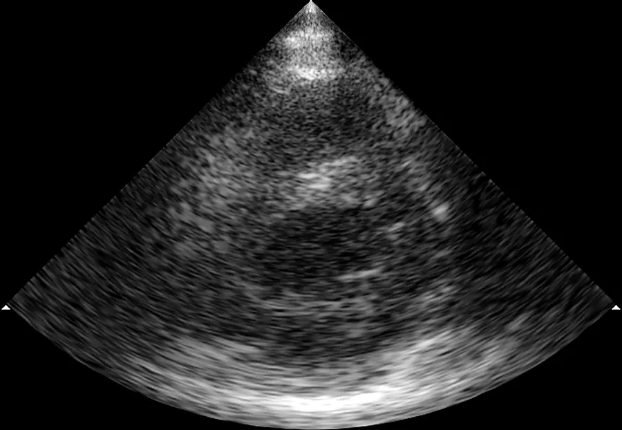 Cardiac ultrasound recorded through the CardioKit probe, looping over one heartbeat, with the tracked target moving in and out of the planned gating window drawn over it.